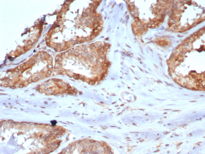 Carm1 Antibody (CARM1/7426)