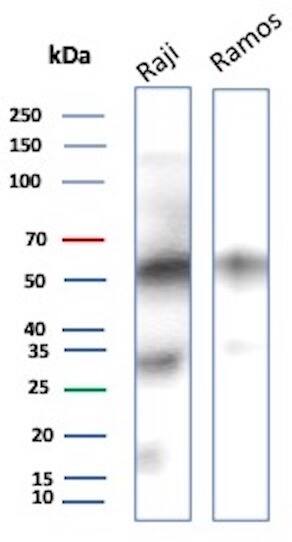CD27/TNFRSF7 Antibody (LPFS2/8574R) Western Blot: CD27/TNFRSF7 Antibody (LPFS2/8574R) [NBP3-20596] -