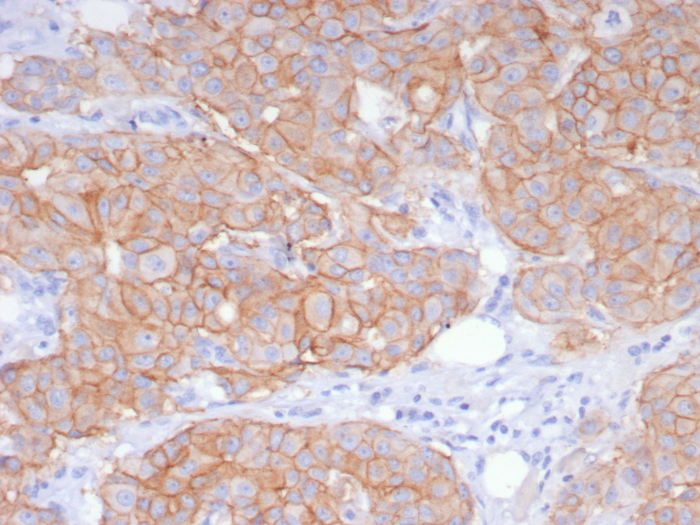 ErbB2/Her2 Antibody (ERBB2/8142R)