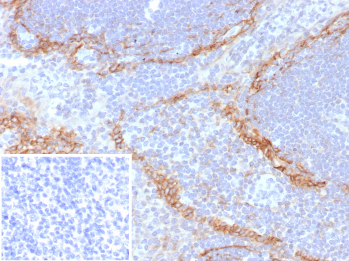 Podoplanin Antibody (rPDPN/6994)