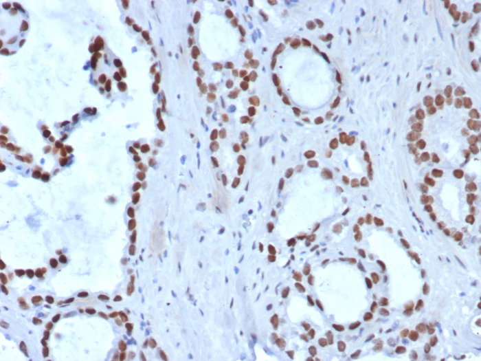 TLE1 Antibody (TLE1/8007R)