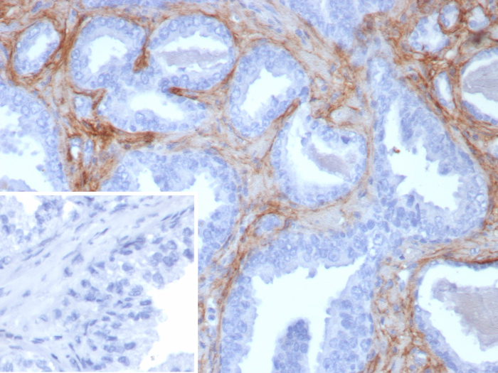 Periostin/OSF-2 Antibody (rPOSTN/8522)