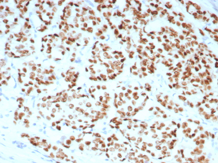 ER alpha/NR3A1 Antibody (rESR1/8761)