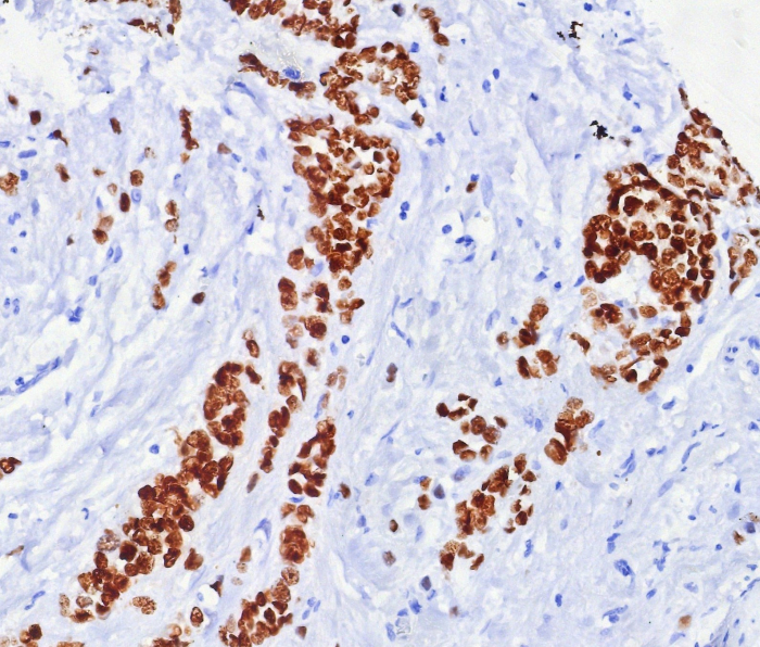 ER alpha/NR3A1 Antibody (ESR1/7444R)