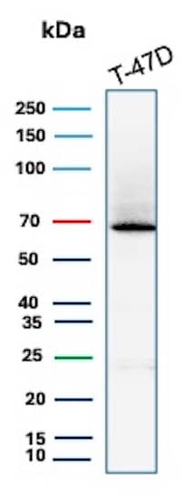 ER alpha/NR3A1 Antibody (ESR1/7444R) Western Blot: ER alpha/NR3A1 Antibody (ESR1/7444R) [NBP3-20628] -
