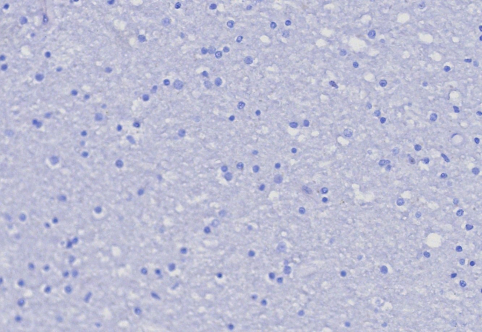 PSGL-1/CD162 Antibody (PSGL1/8192R)