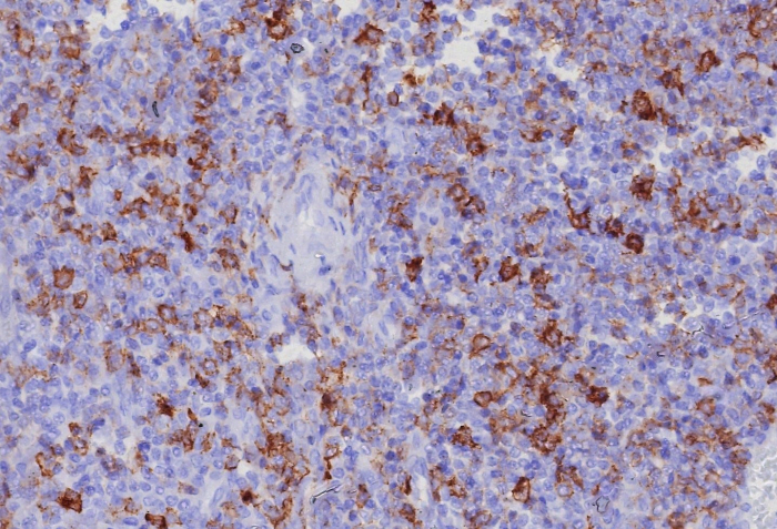 PSGL-1/CD162 Antibody (PSGL1/8192R)