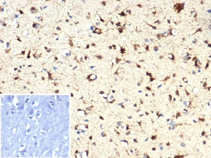 Isocitrate Dehydrogenase 1/IDH1 Antibody (IDH1.R132H/7328R)