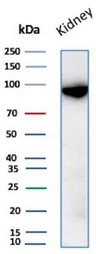 Neprilysin/CD10 Antibody (MME/8376R) Western Blot: Neprilysin/CD10 Antibody (MME/8376R) [NBP3-20635] -