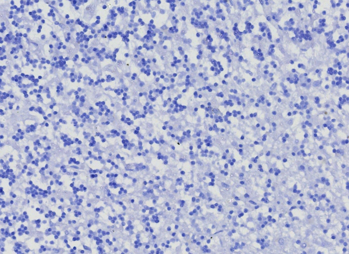 Neprilysin/CD10 Antibody (MME/8376R)