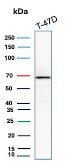 ER alpha/NR3A1 Antibody (ESR1/8407R) Western Blot: ER alpha/NR3A1 Antibody (ESR1/8407R) [NBP3-20638] -