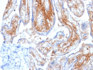 Decorin Antibody (DCN/6289)