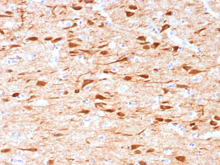 NECAB1 Antibody (NECAB1/7677)