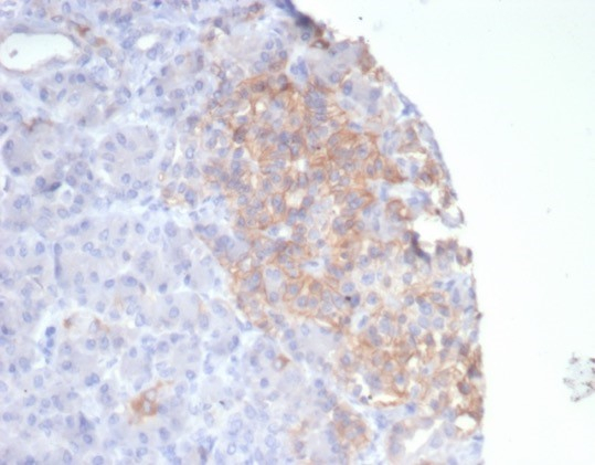 Somatostatin R2/SSTR2 Antibody (SSTR2/7532)