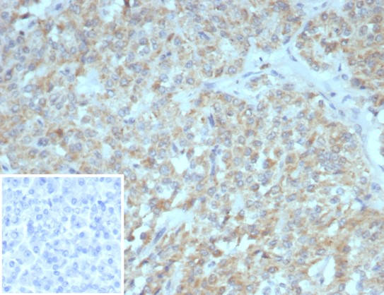 Somatostatin R2/SSTR2 Antibody (SSTR2/7532)