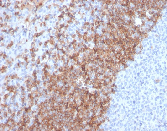 IgD Antibody (IGHD/2730R)