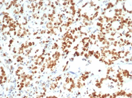 EZH2/KMT6 Antibody (EZH2/6988)