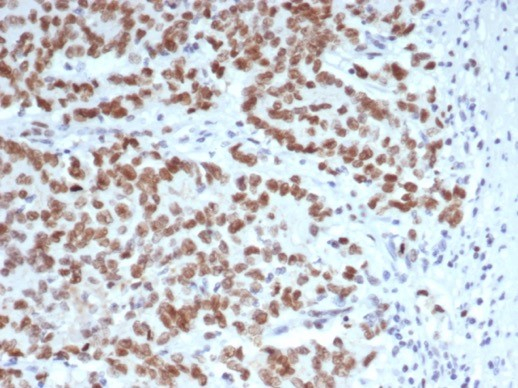EZH2/KMT6 Antibody (EZH2/6988)