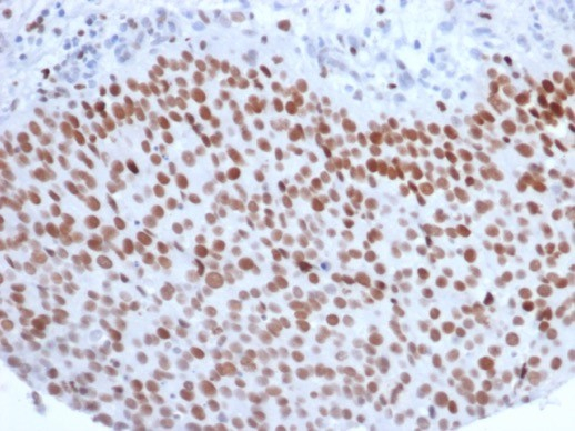 EZH2/KMT6 Antibody (EZH2/6988)