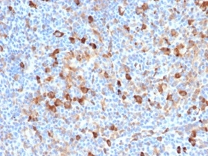 Fascin Antibody (FSCN1/7209)