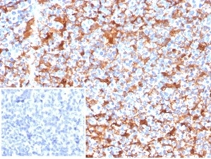 Fascin Antibody (FSCN1/7209)