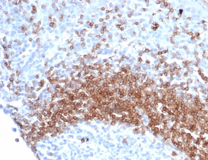IgD Antibody (IGHD/6818R)