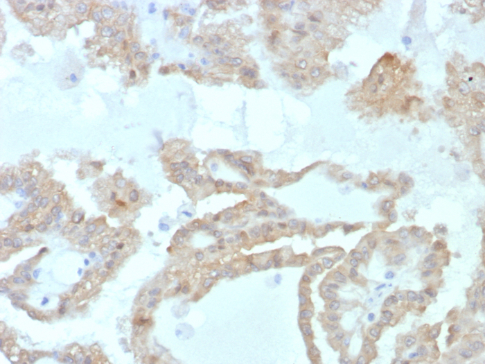 FABP2/I-FABP Antibody (FABP2/7669)