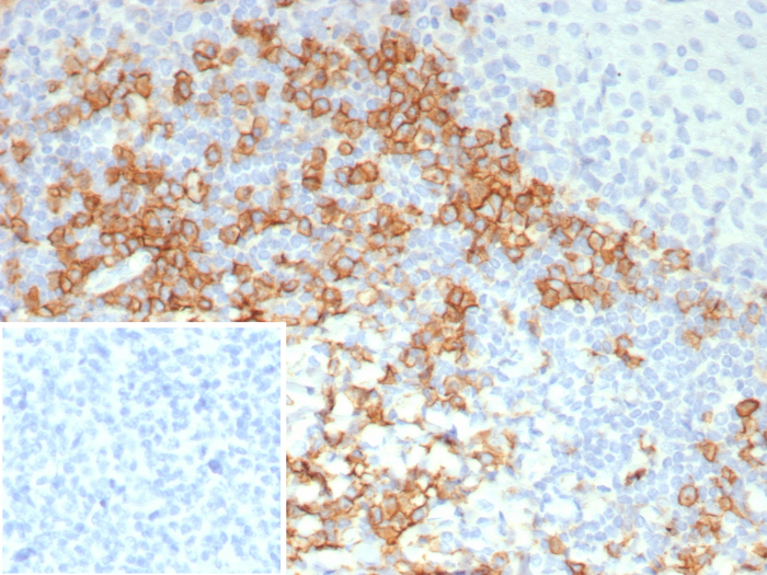 CD38 Antibody (CD38/8114R)