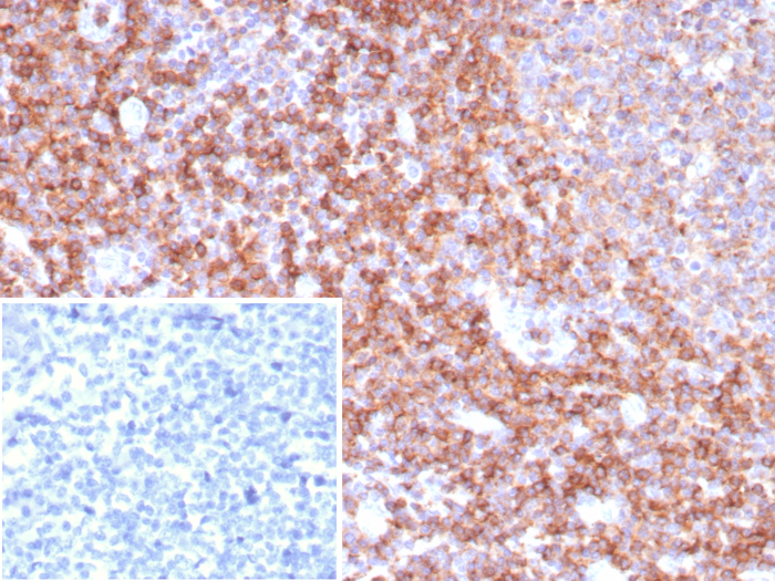 CD39/ENTPD1 Antibody (CD39/8538R)