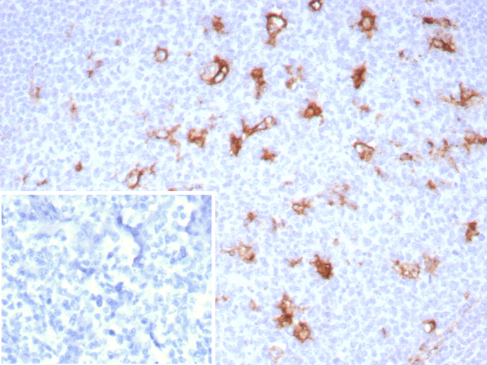 SPARC Antibody (OSTN/8528R)