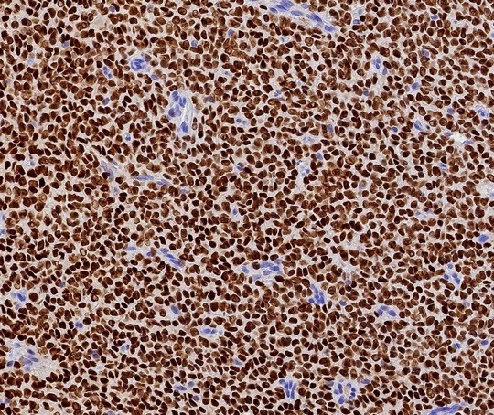 FOXL2 Antibody (FOXL2/7989R)