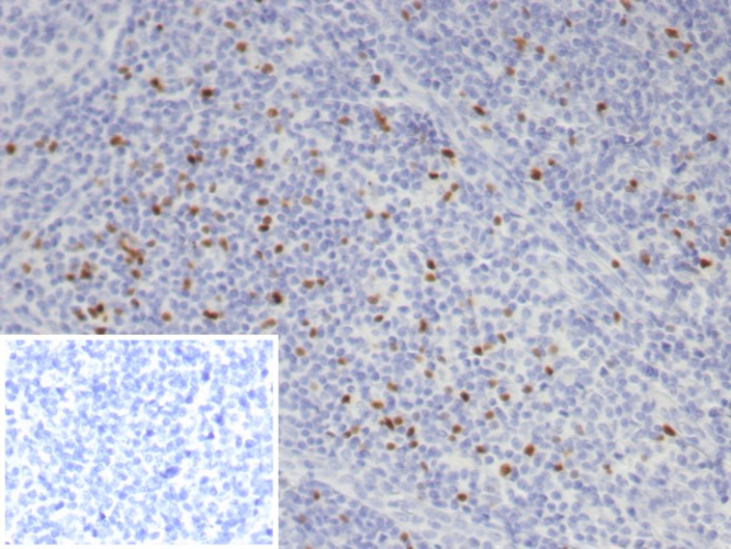 FoxP3 Antibody (FOXP3/7990R)