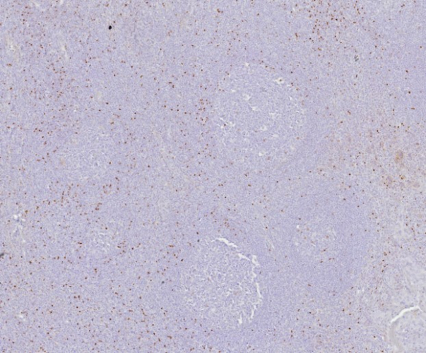 FoxP3 Antibody (FOXP3/8145R)