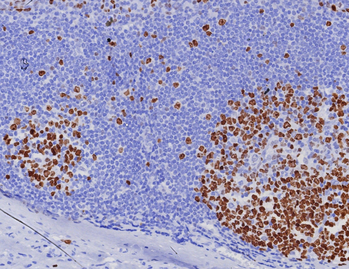 Ki67/MKI67 Antibody (MKI67/8005R)