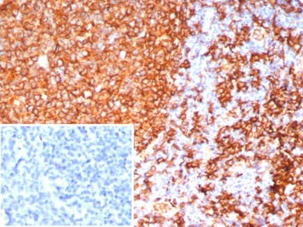 HLA DRB1 Antibody (HLA-DRB/7795R) - Azide and BSA Free