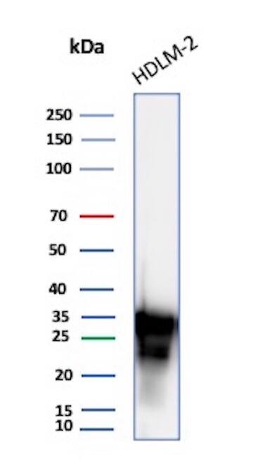 HLA DRB1 Antibody (HLA-DRB/7795R) - Azide and BSA Free Western Blot: HLA DRB1 Antibody (HLA-DRB/7795R) - Azide and BSA Free [NBP3-20688] -