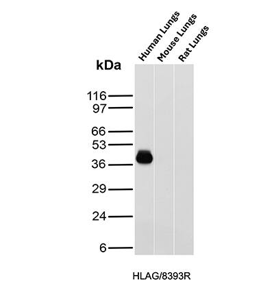 HLA G Antibody (HLAG/8393R) - Azide and BSA Free Western Blot: HLA G Antibody (HLAG/8393R) - Azide and BSA Free [NBP3-20690] -