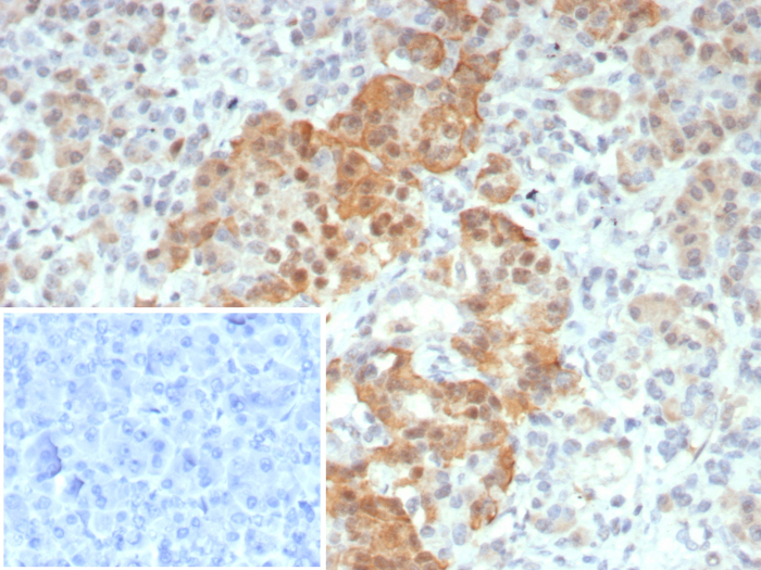 INSM1 Antibody (INSM1/8122R) - Azide and BSA Free