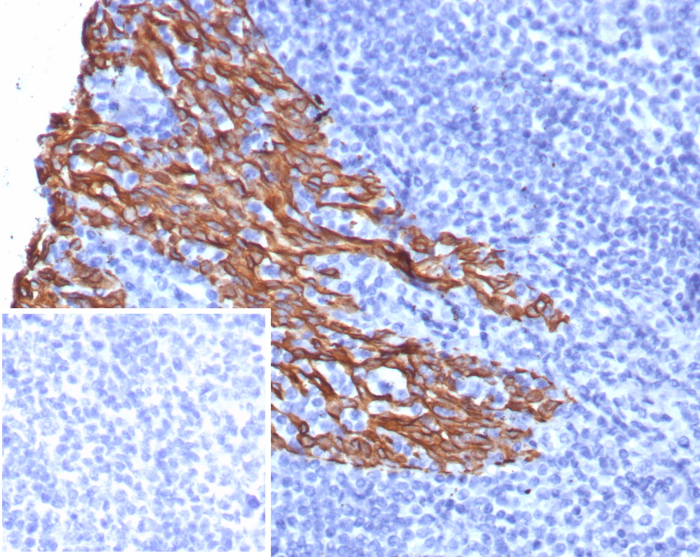 Cytokeratin 5 Antibody (rKRT5/6969) - Azide and BSA Free
