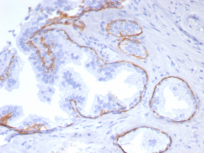 Cytokeratin 5 Antibody (rKRT5/6969) - Azide and BSA Free