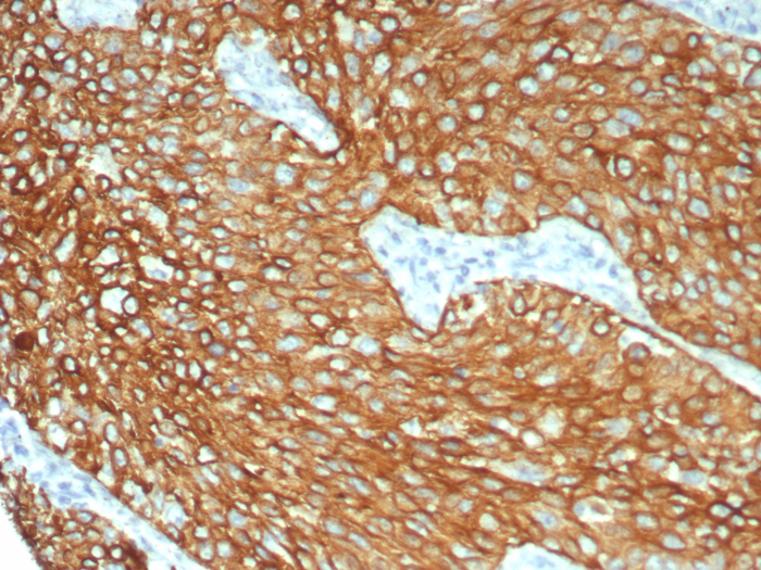 Cytokeratin 6 Antibody (KRT6/8198R) - Azide and BSA Free