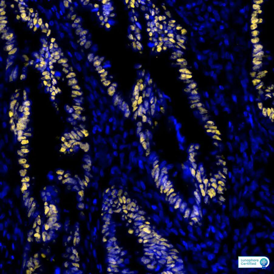 p53 Antibody (BP53-12) - IHC-Prediluted p53 Antibody (BP53-12)