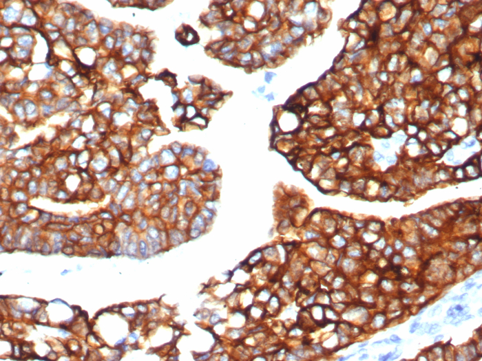Cytokeratin 7 Antibody (KRT7/8121R) - Azide and BSA Free