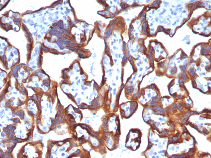 Cytokeratin 7 Antibody (KRT7/8121R) - Azide and BSA Free