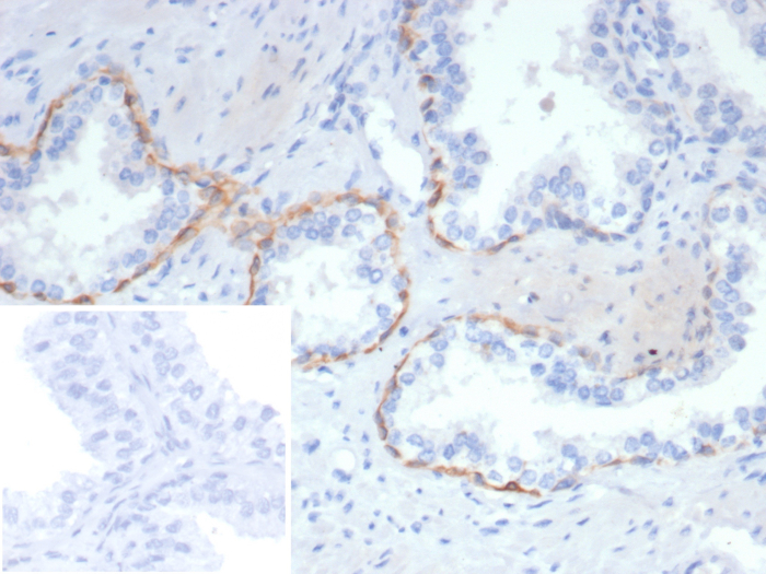 Cytokeratin 14 Antibody (rKRT14/7269) - Azide and BSA Free