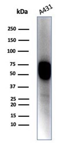 Cytokeratin 14 Antibody (KRT14/4128) - Azide and BSA Free Western Blot: Cytokeratin 14 Antibody (KRT14/4128) - Azide and BSA Free [NBP3-20728] -