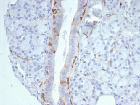 Cytokeratin 14 Antibody (KRT14/7047R) - Azide and BSA Free