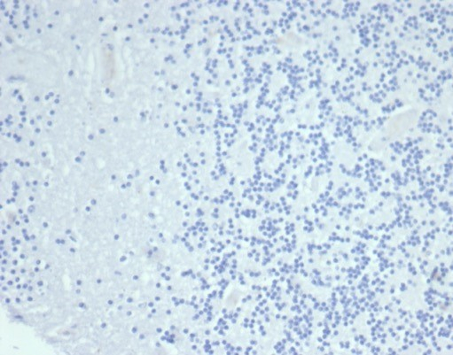 Cytokeratin 14 Antibody (KRT14/6987R) - Azide and BSA Free