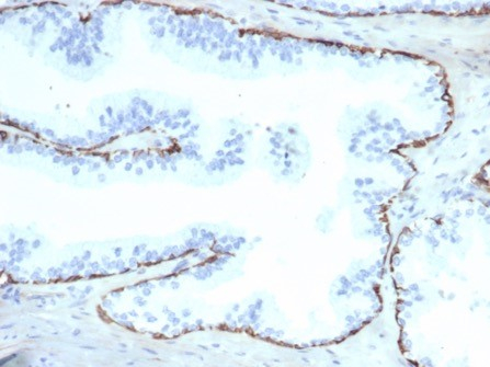 Cytokeratin 14 Antibody (KRT14/6987R) - Azide and BSA Free
