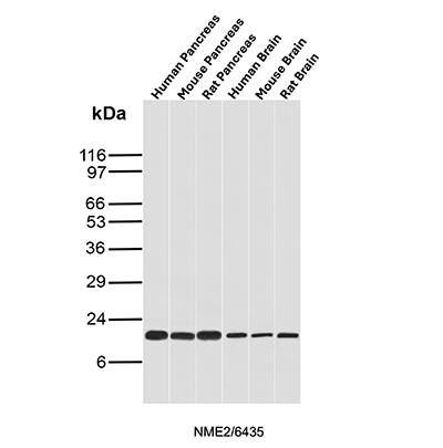 NM23-H2/NME2 Antibody (NME2/6435) - Azide and BSA Free Western Blot: NM23-H2/NME2 Antibody (NME2/6435) - Azide and BSA Free [NBP3-20732] -